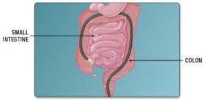 intestine:colon